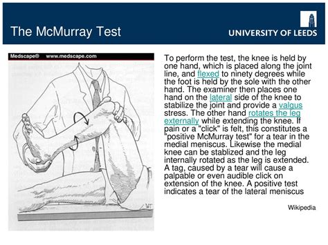 positive mcmurray test meaning